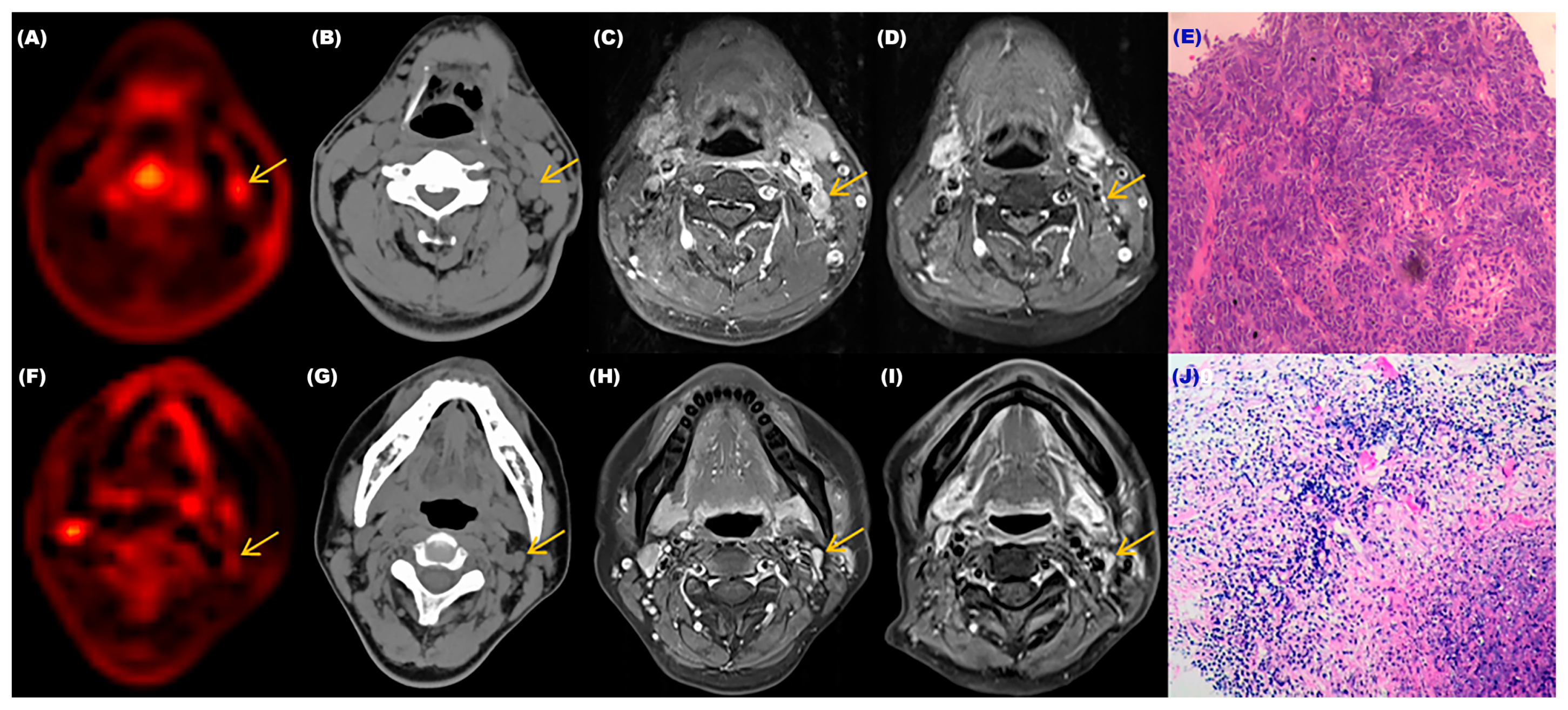 Diagnostics 13 02530 g005 Diagnostics 13 02530 g005