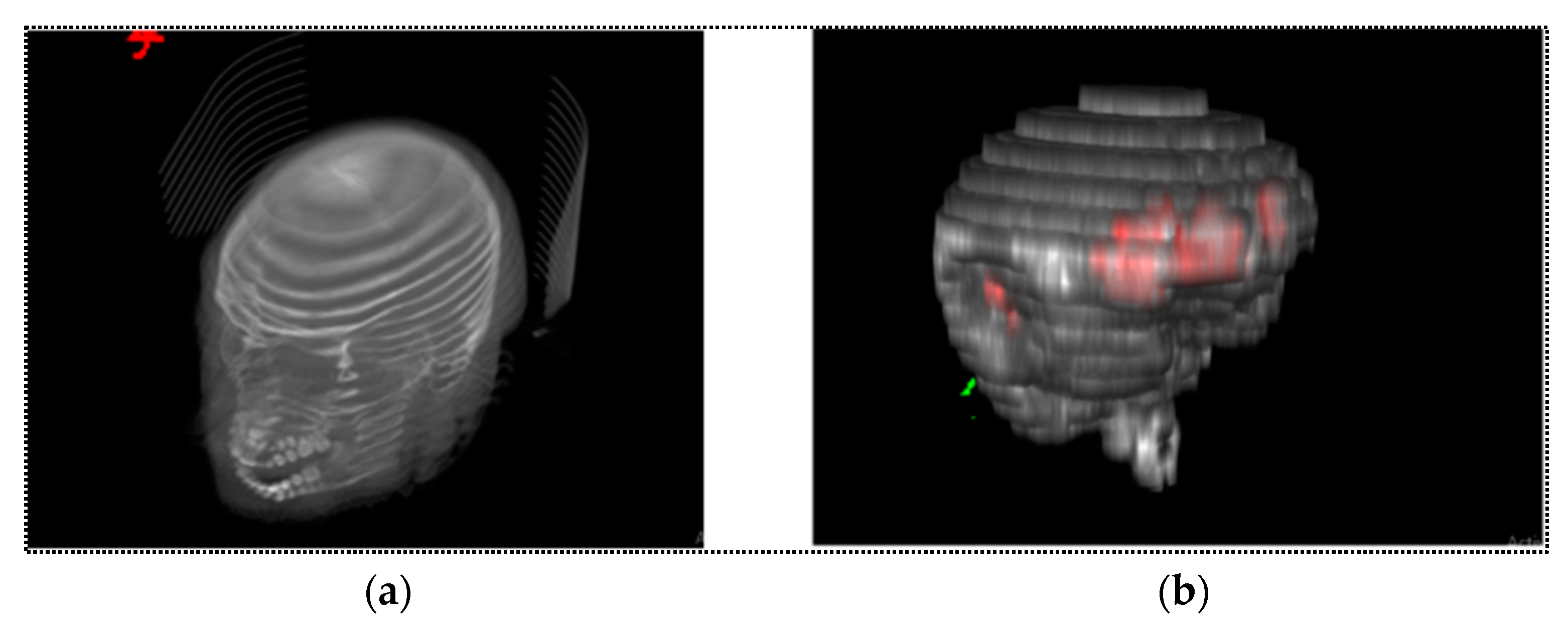 Diagnostics 13 02537 g006 Diagnostics 13 02537 g006