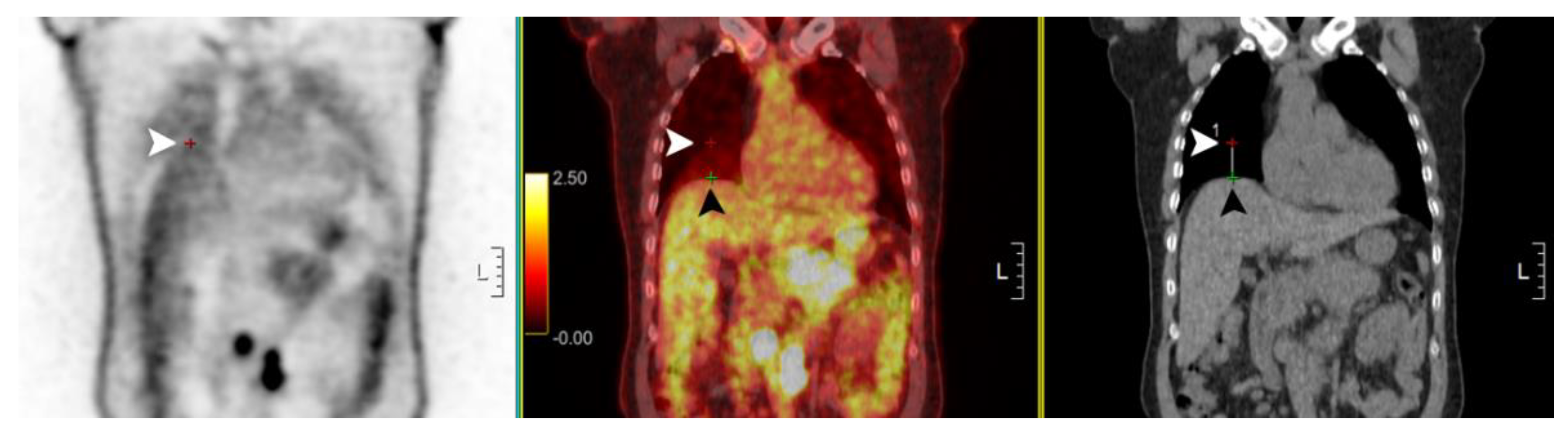 Diagnostics 13 02539 g003