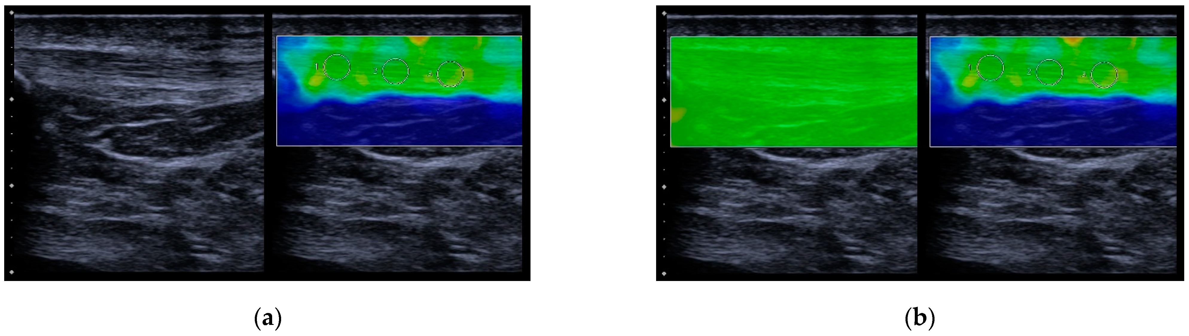 Diagnostics 13 02541 g002