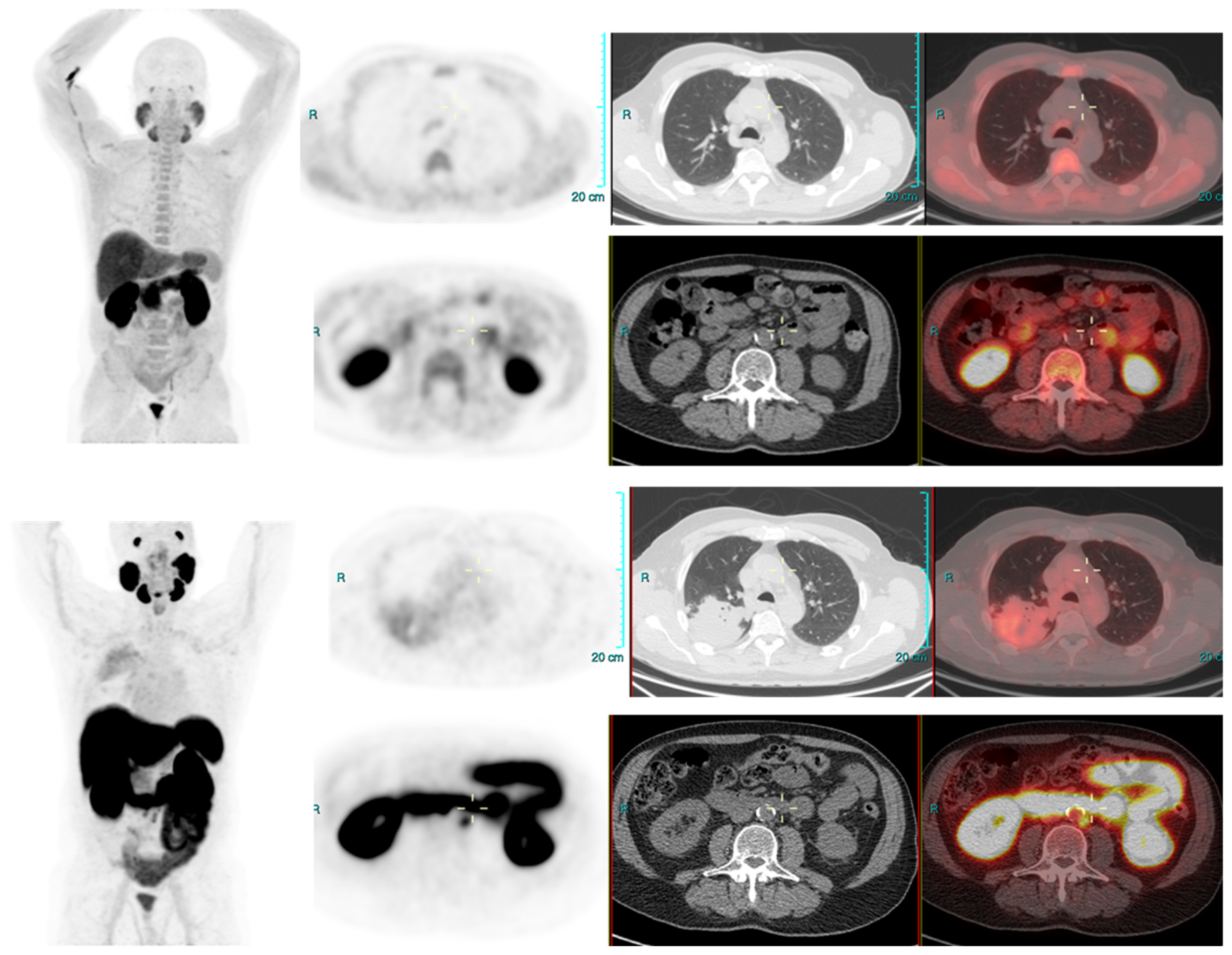 Diagnostics 13 02542 g003