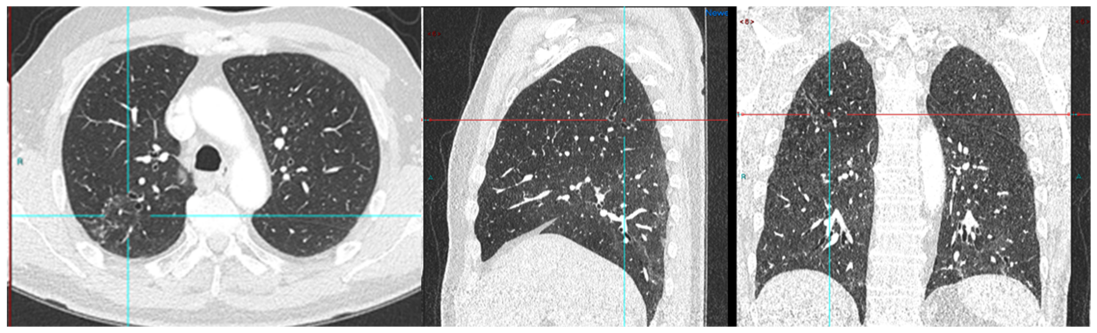 Diagnostics 13 02542 g004