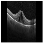 Diagnostics 13 02550 i001