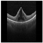 Diagnostics 13 02550 i004