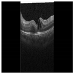 Diagnostics 13 02550 i007