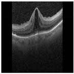 Diagnostics 13 02550 i010
