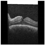 Diagnostics 13 02550 i016