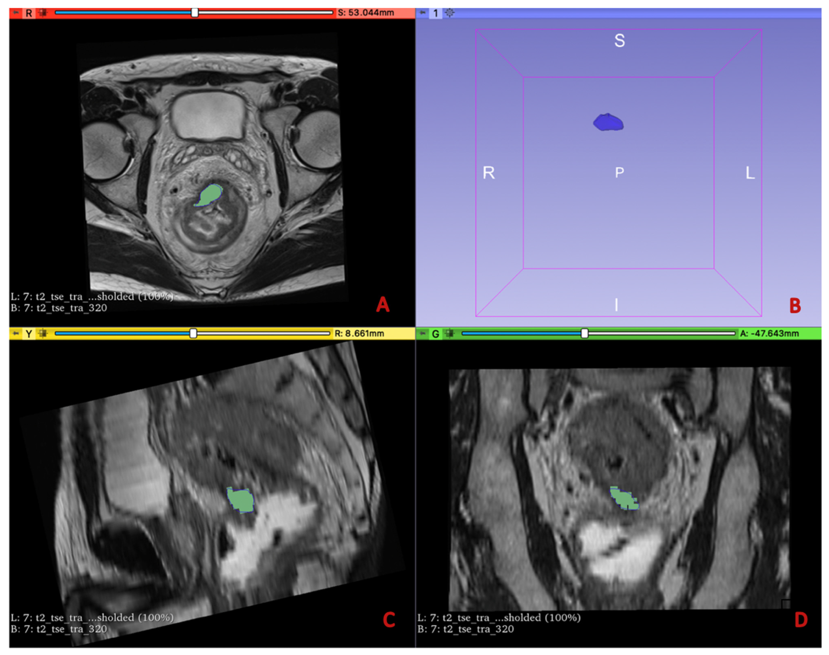 Diagnostics 13 02573 g002