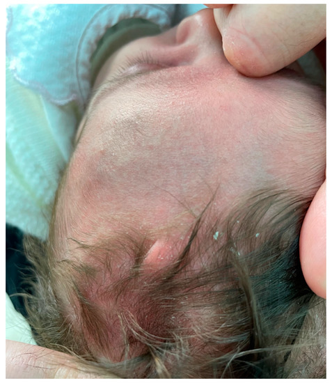 Diagnostics 13 02574 g001 550