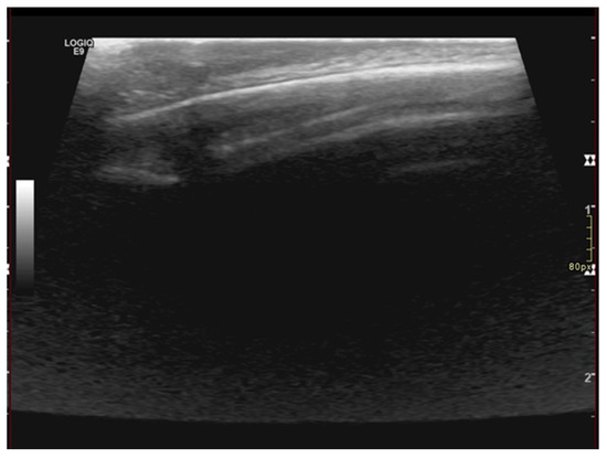 Diagnostics 13 02574 g002 550