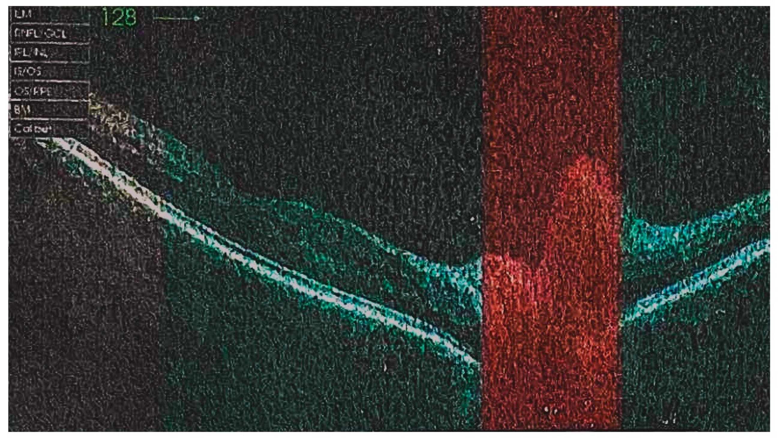 Diagnostics 13 02579 g001 Diagnostics 13 02579 g001