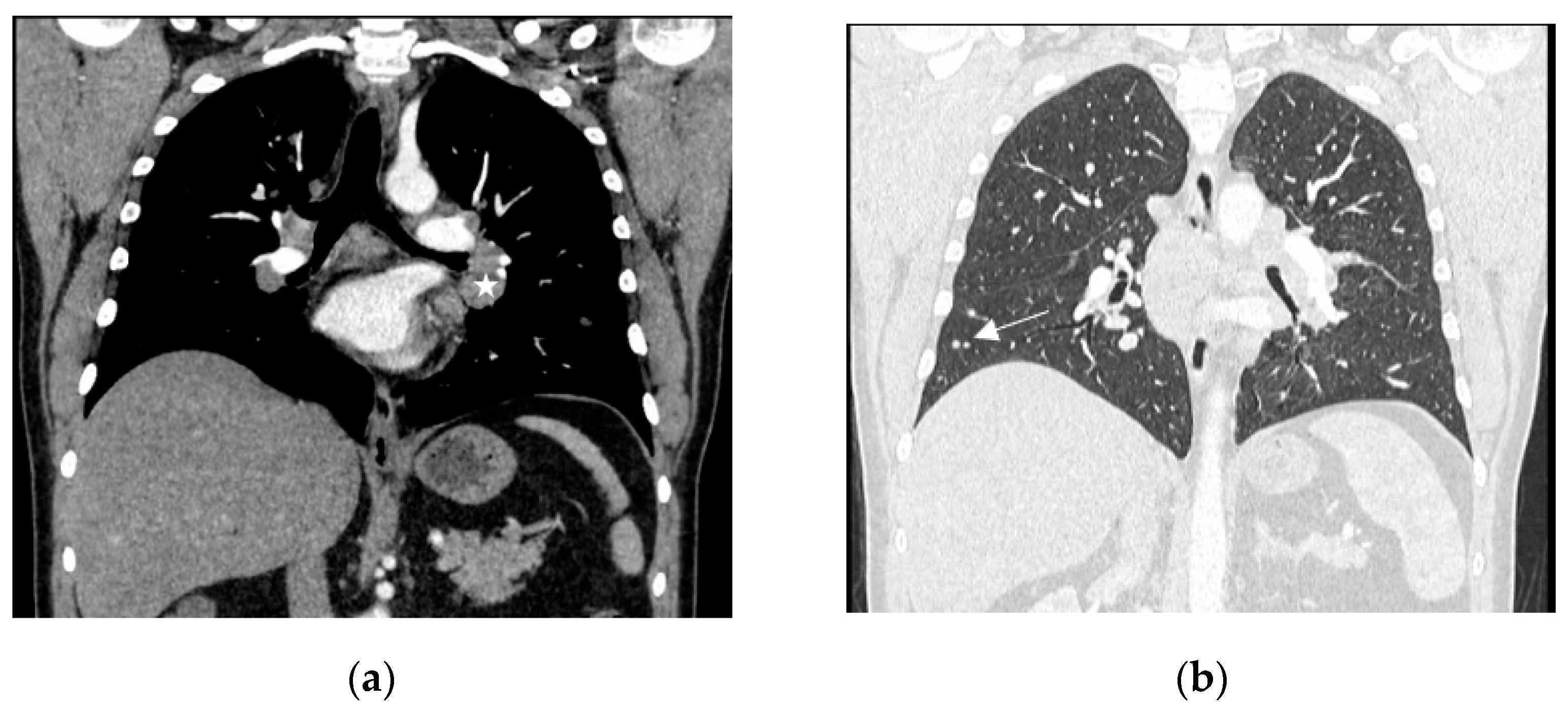 Diagnostics 13 02579 g002 Diagnostics 13 02579 g002