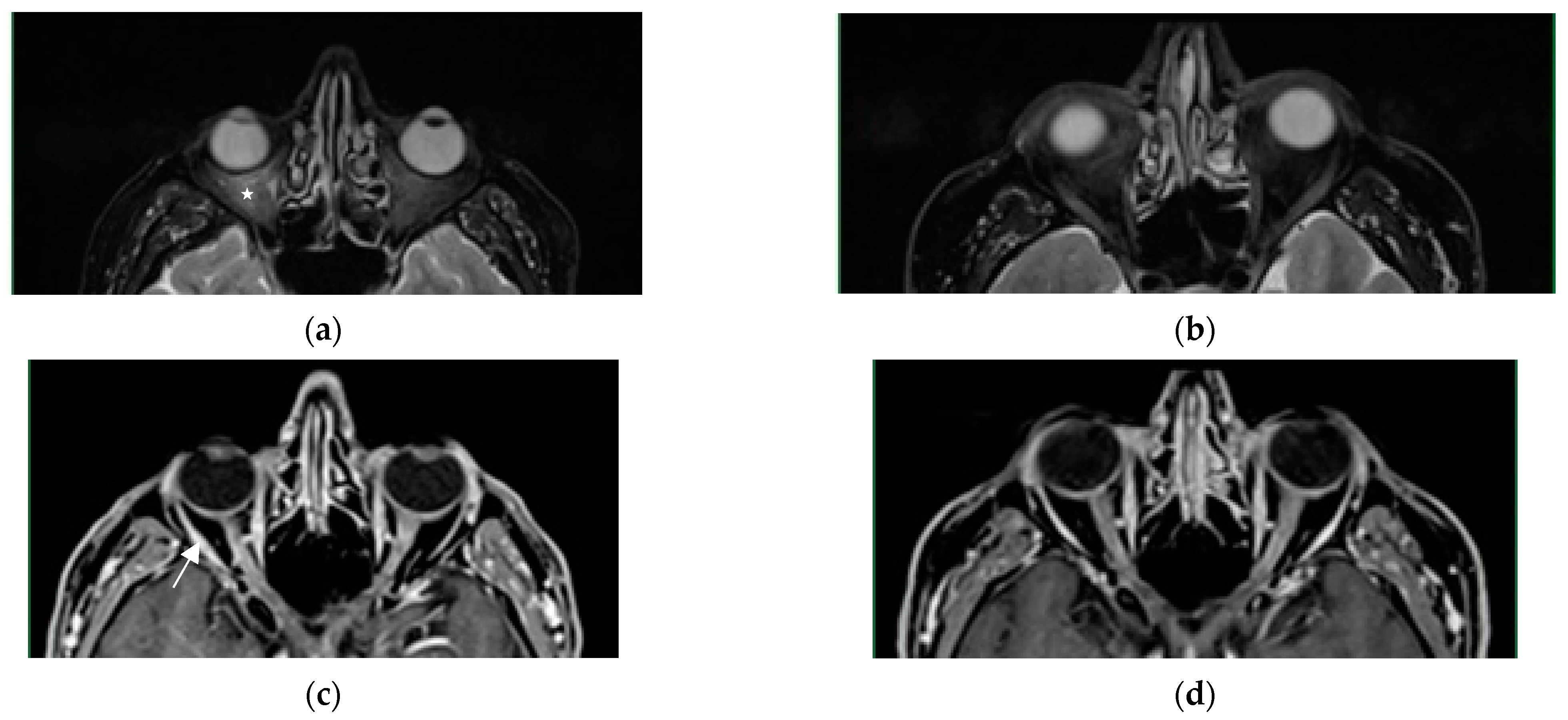 Diagnostics 13 02579 g004 Diagnostics 13 02579 g004