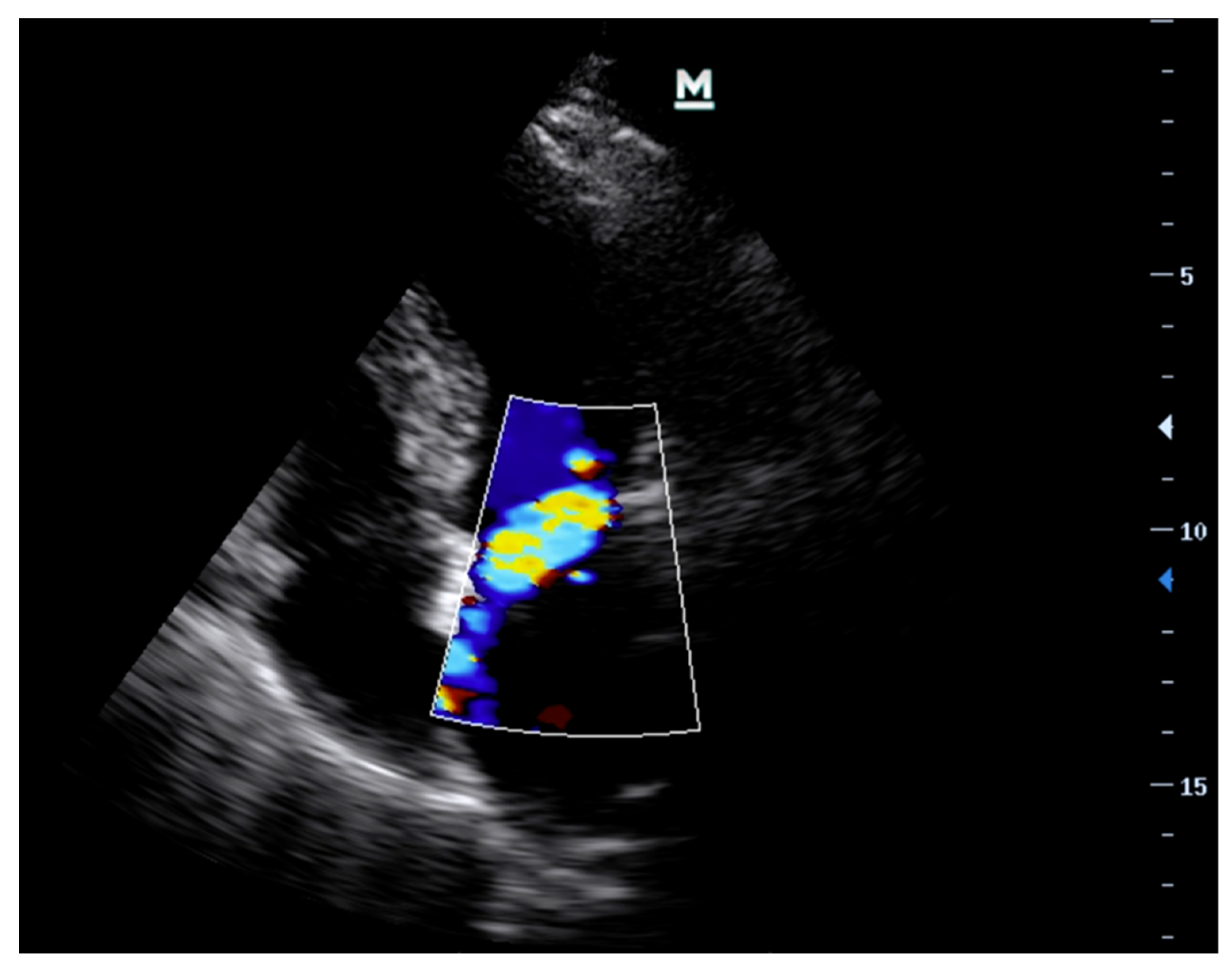 Diagnostics 13 02581 g004 Diagnostics 13 02581 g004
