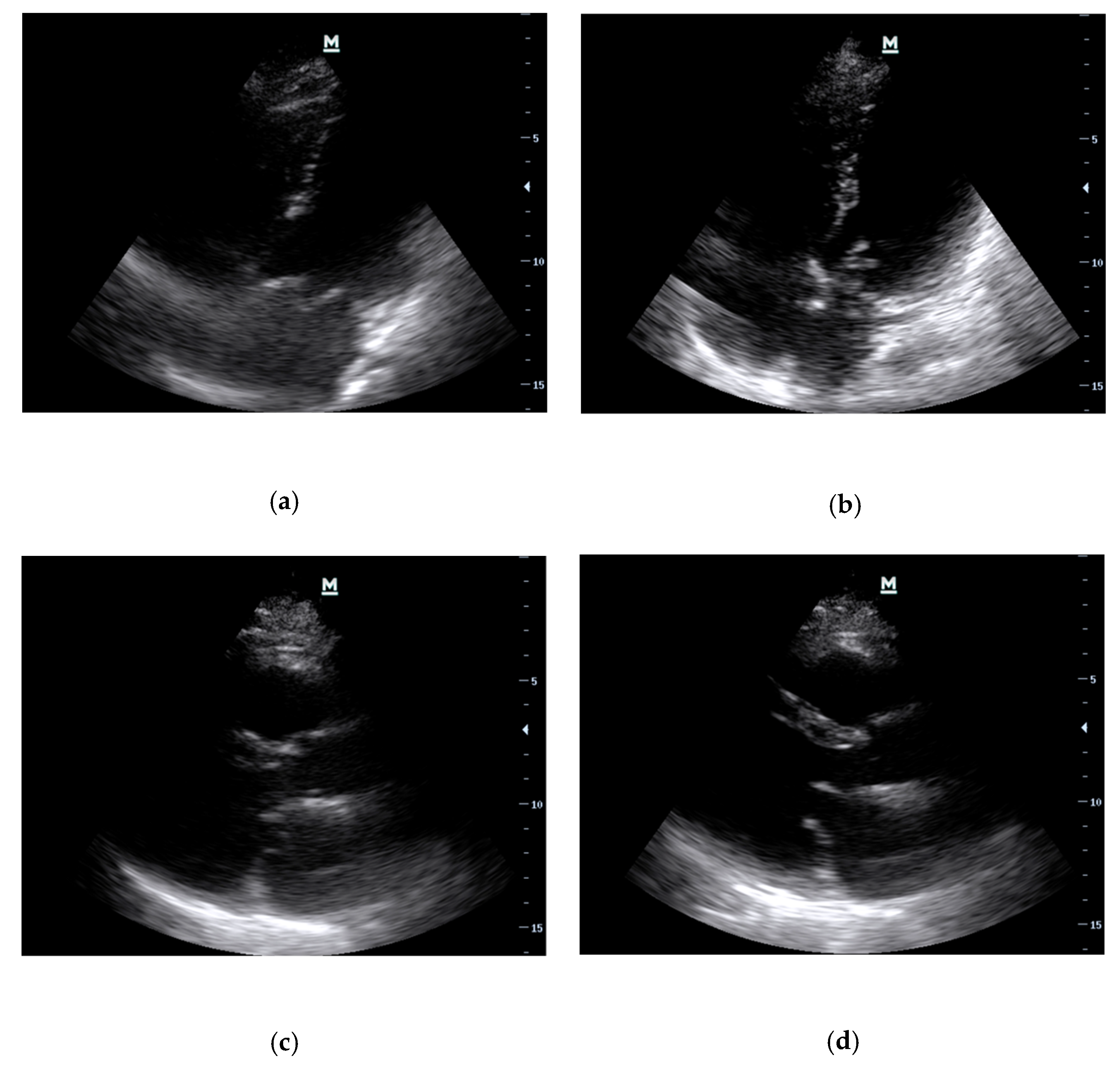 Diagnostics 13 02581 g005 Diagnostics 13 02581 g005