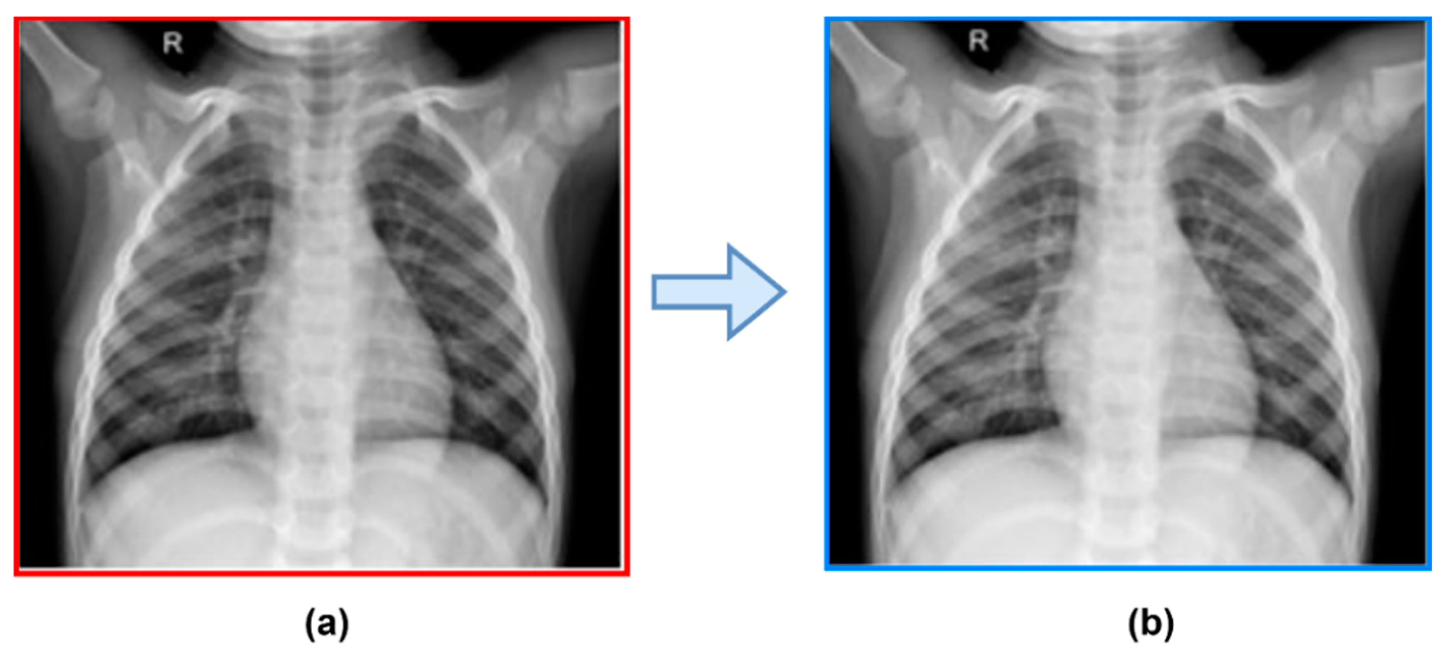 Diagnostics 13 02583 g005 Diagnostics 13 02583 g005