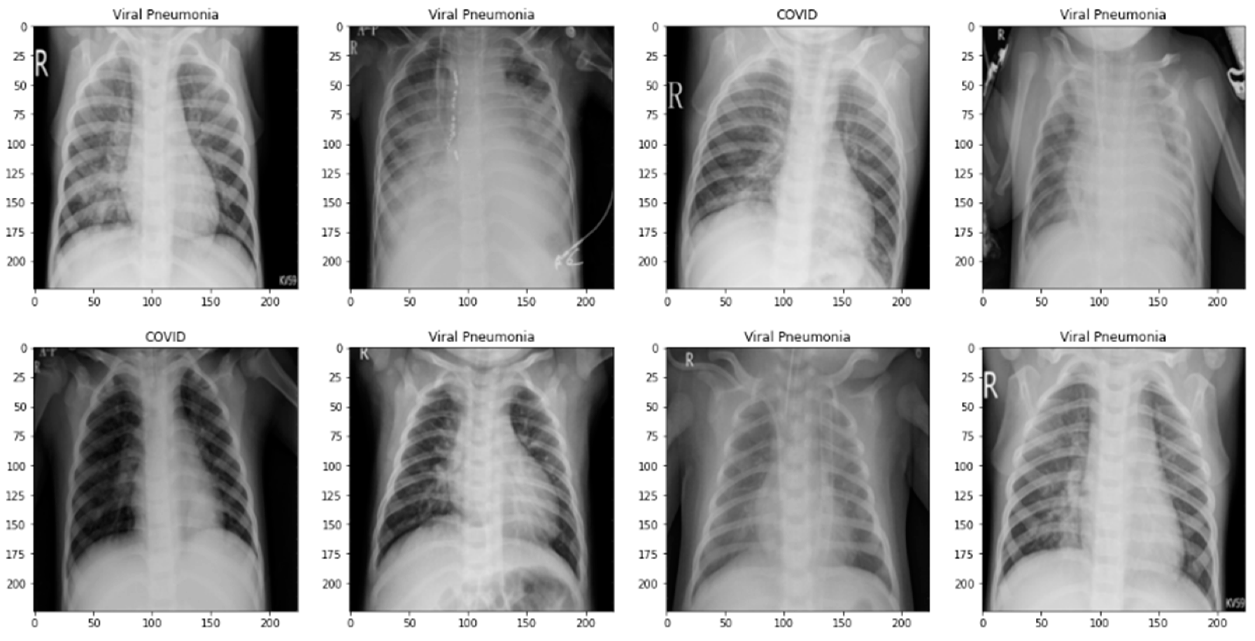 Diagnostics 13 02583 g015 Diagnostics 13 02583 g015