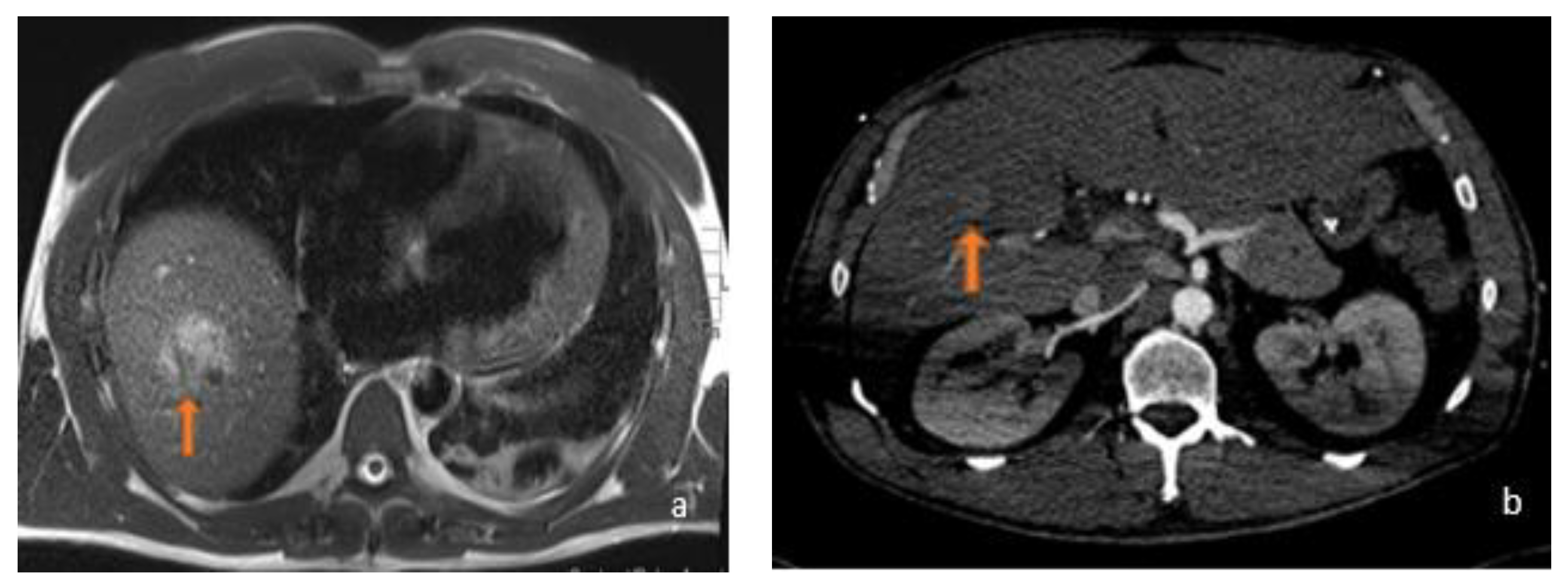 Diagnostics 13 02591 g002