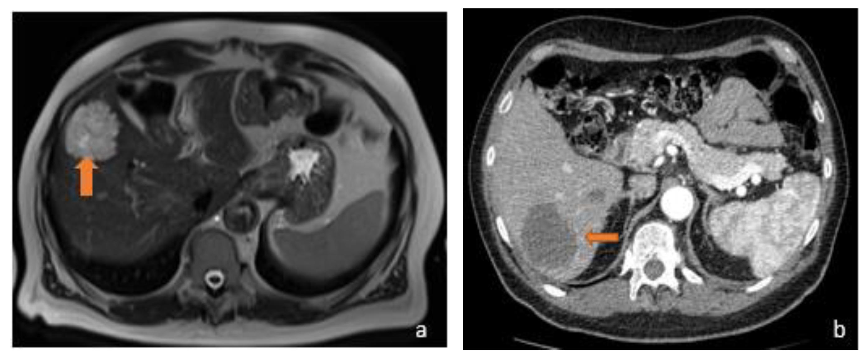 Diagnostics 13 02591 g003