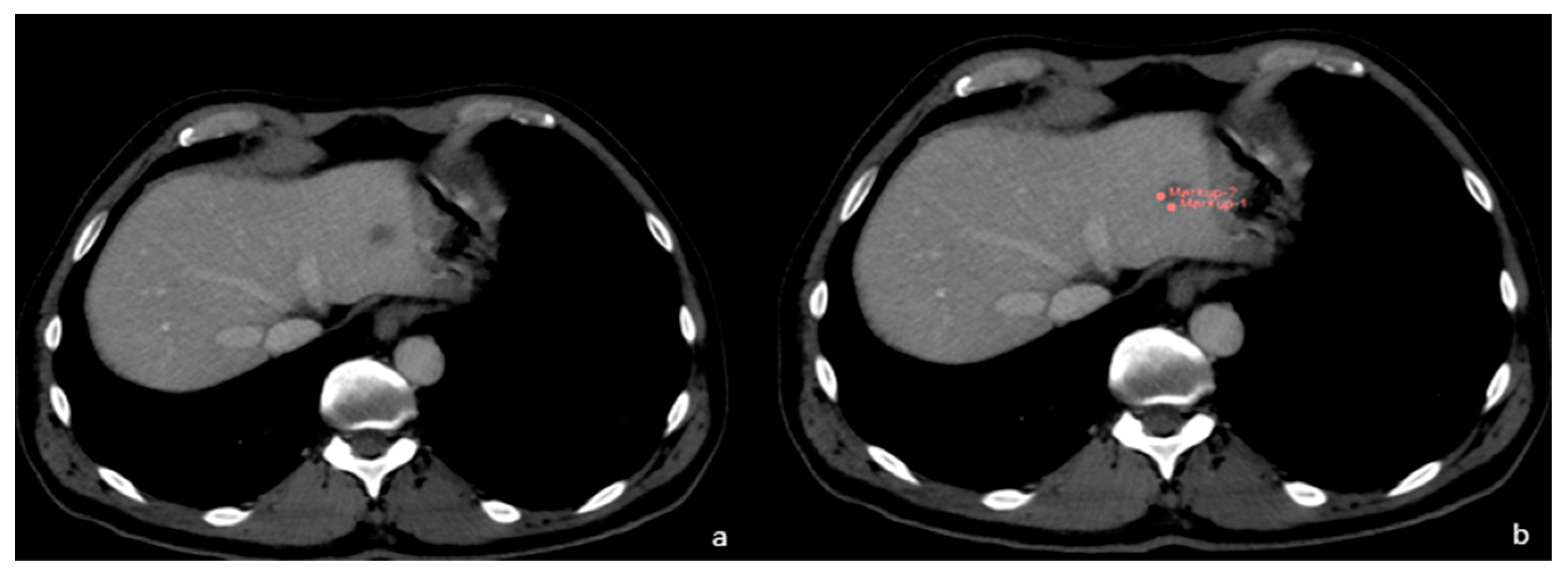 Diagnostics 13 02591 g004