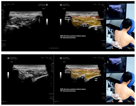 Diagnostics 13 02601 g002a