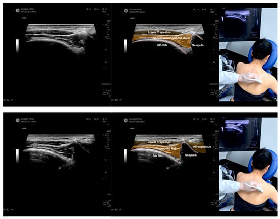 Diagnostics 13 02601 g002d