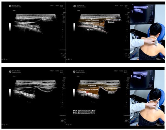 Diagnostics 13 02601 g002e
