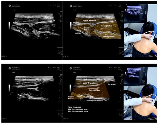 Diagnostics 13 02601 g002f