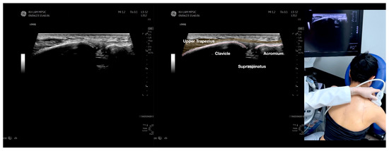 Diagnostics 13 02601 g002g