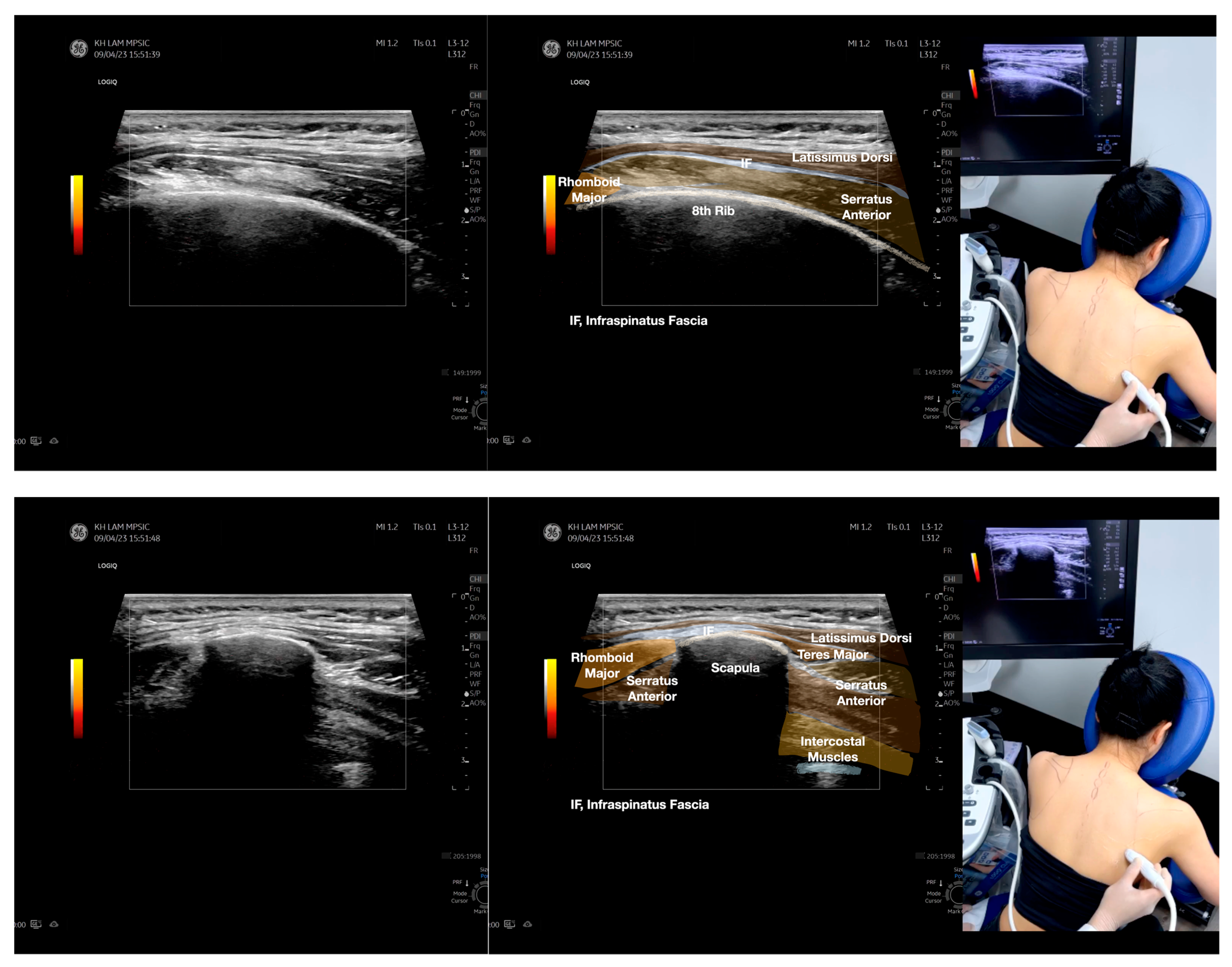 Diagnostics 13 02601 g003a
