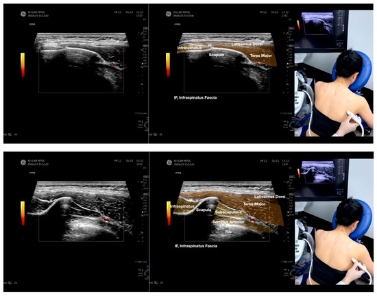 Diagnostics 13 02601 g003b