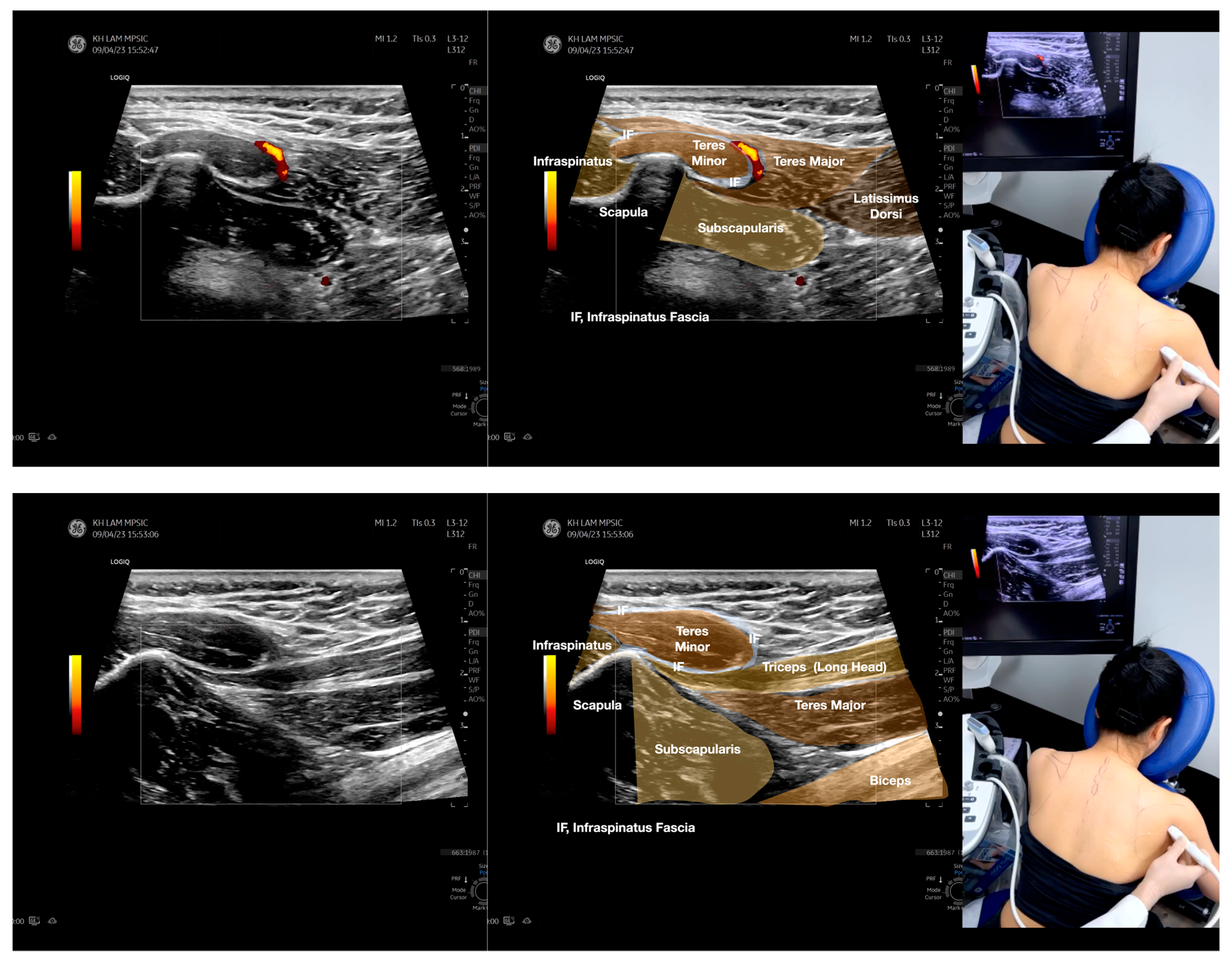 Diagnostics 13 02601 g003c
