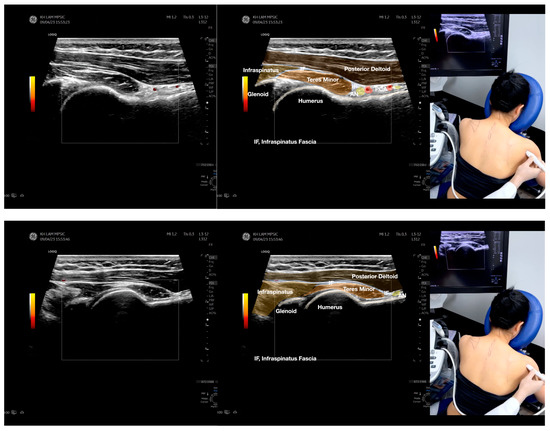 Diagnostics 13 02601 g003d