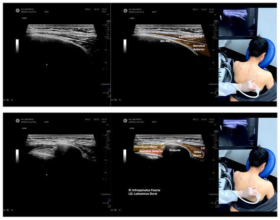 Diagnostics 13 02601 g004a