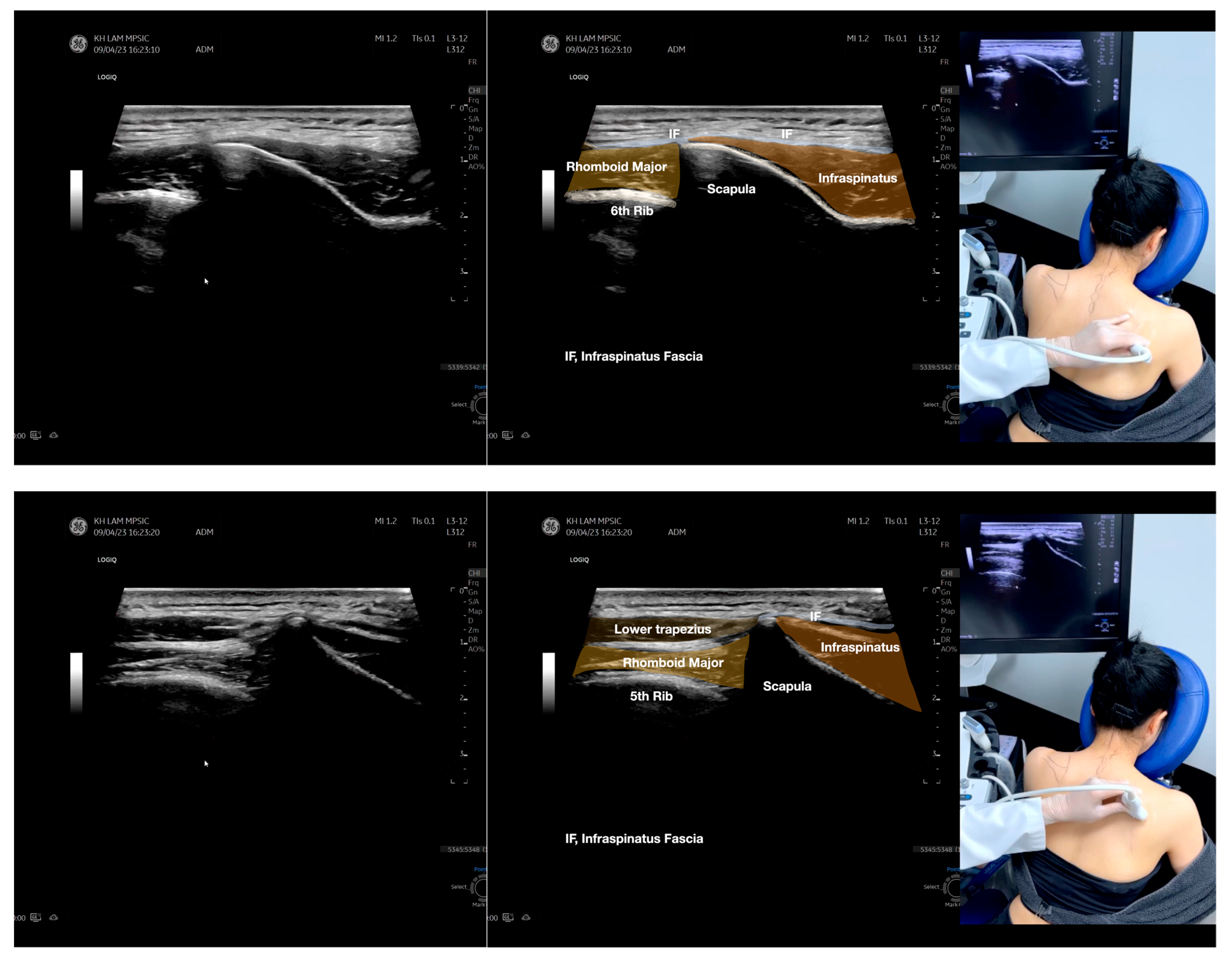 Diagnostics 13 02601 g004b