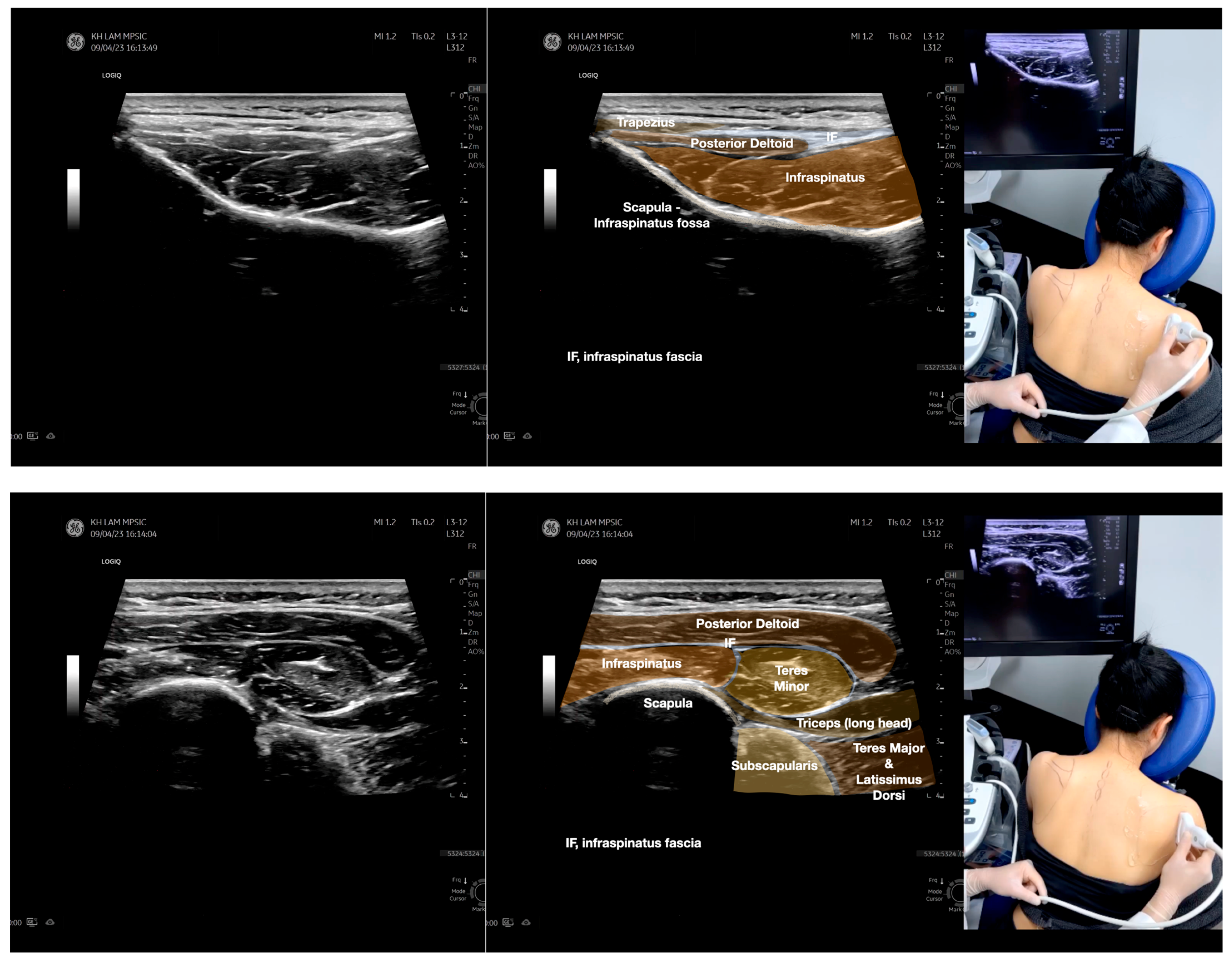 Diagnostics 13 02601 g005b