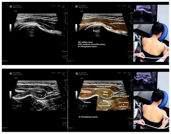 Diagnostics 13 02601 g005c