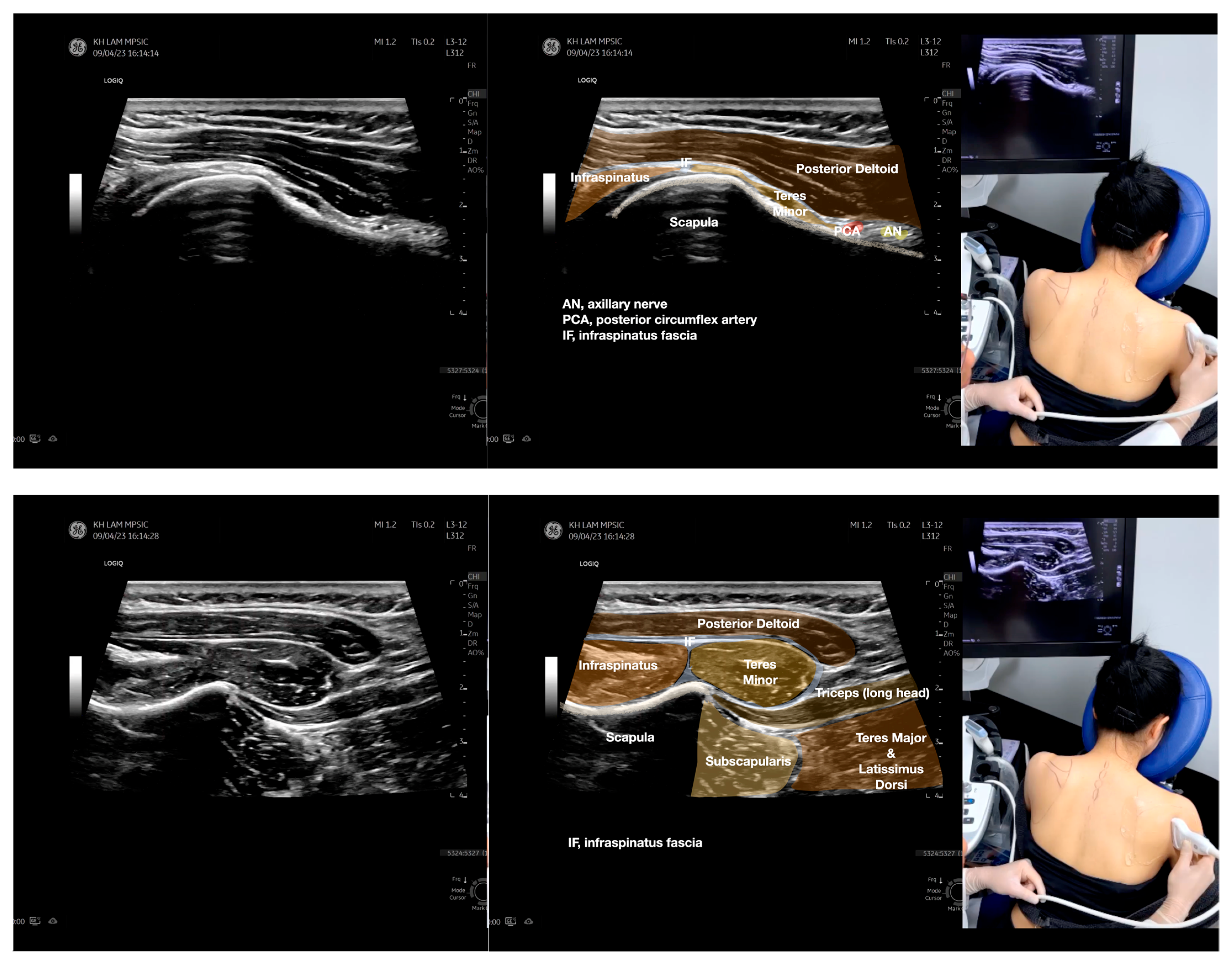 Diagnostics 13 02601 g005c
