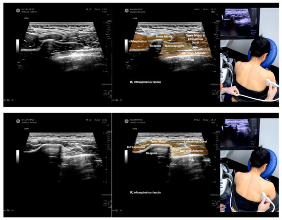 Diagnostics 13 02601 g005d
