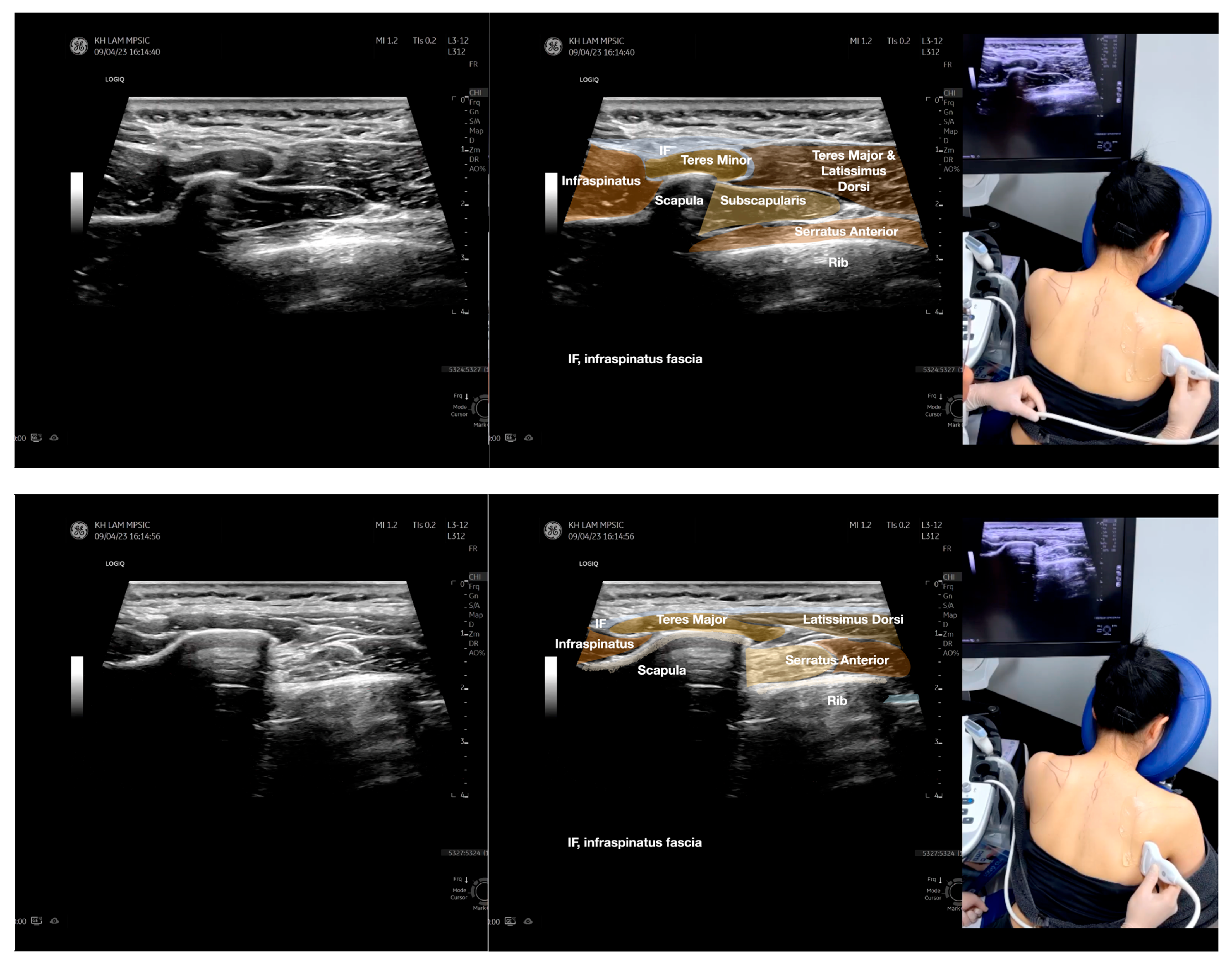 Diagnostics 13 02601 g005d