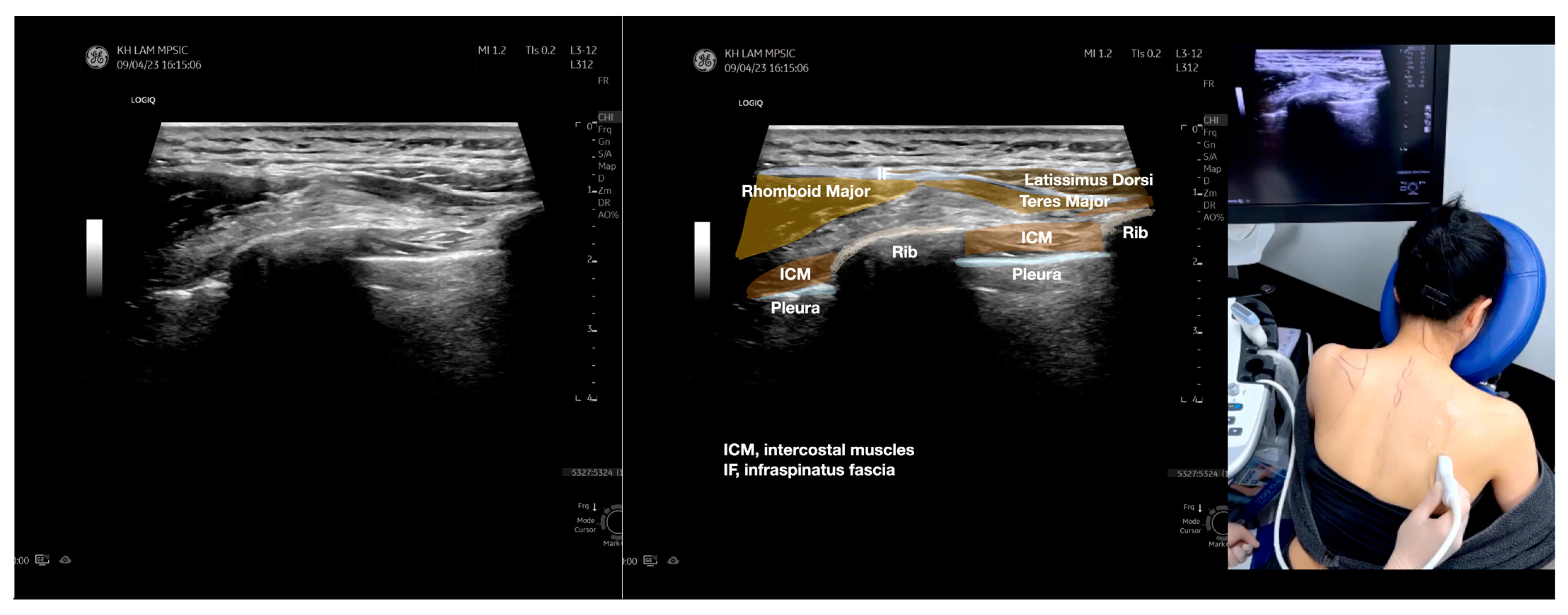 Diagnostics 13 02601 g005e