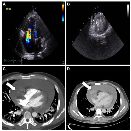 Diagnostics 13 02666 g001