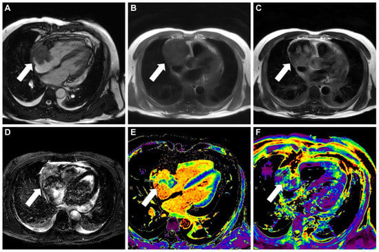 Diagnostics 13 02666 g002