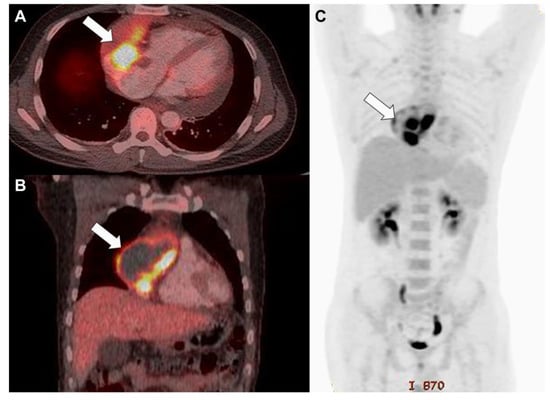 Diagnostics 13 02666 g003