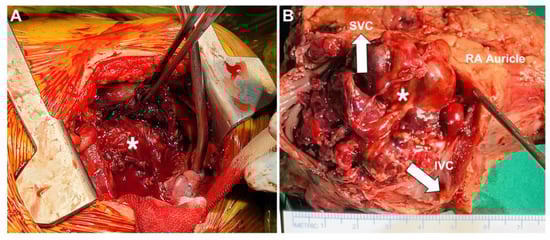 Diagnostics 13 02666 g004