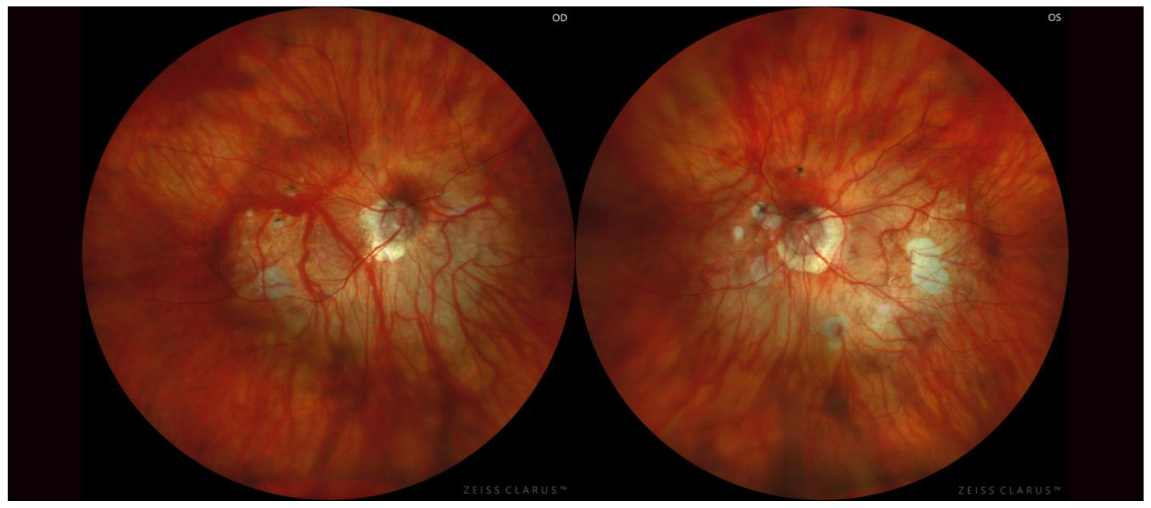 Diagnostics 13 02680 g002 Diagnostics 13 02680 g002