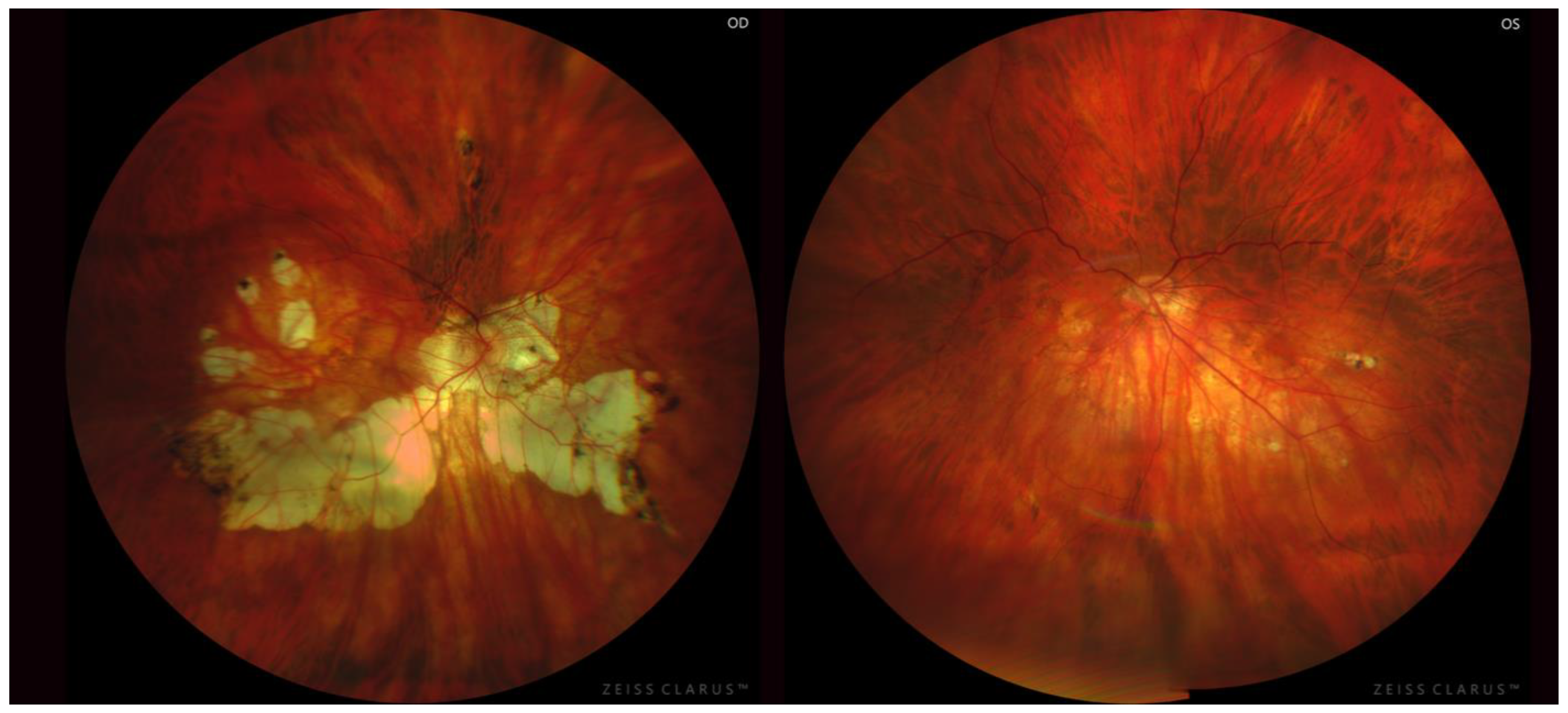 Diagnostics 13 02680 g003 Diagnostics 13 02680 g003