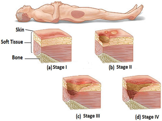 Diagnostics 13 02739 g001
