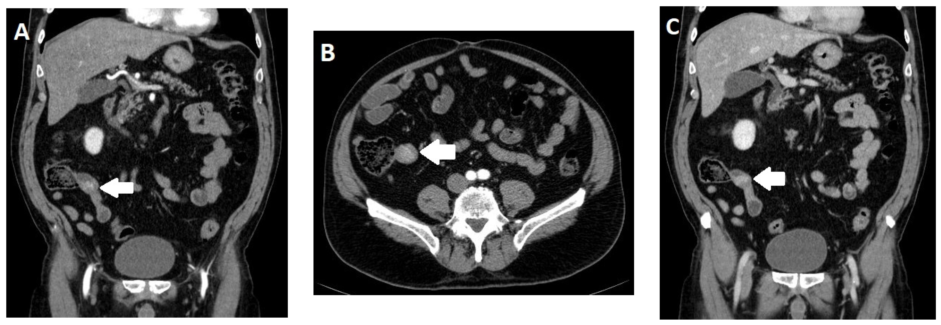 Diagnostics 13 02741 g002