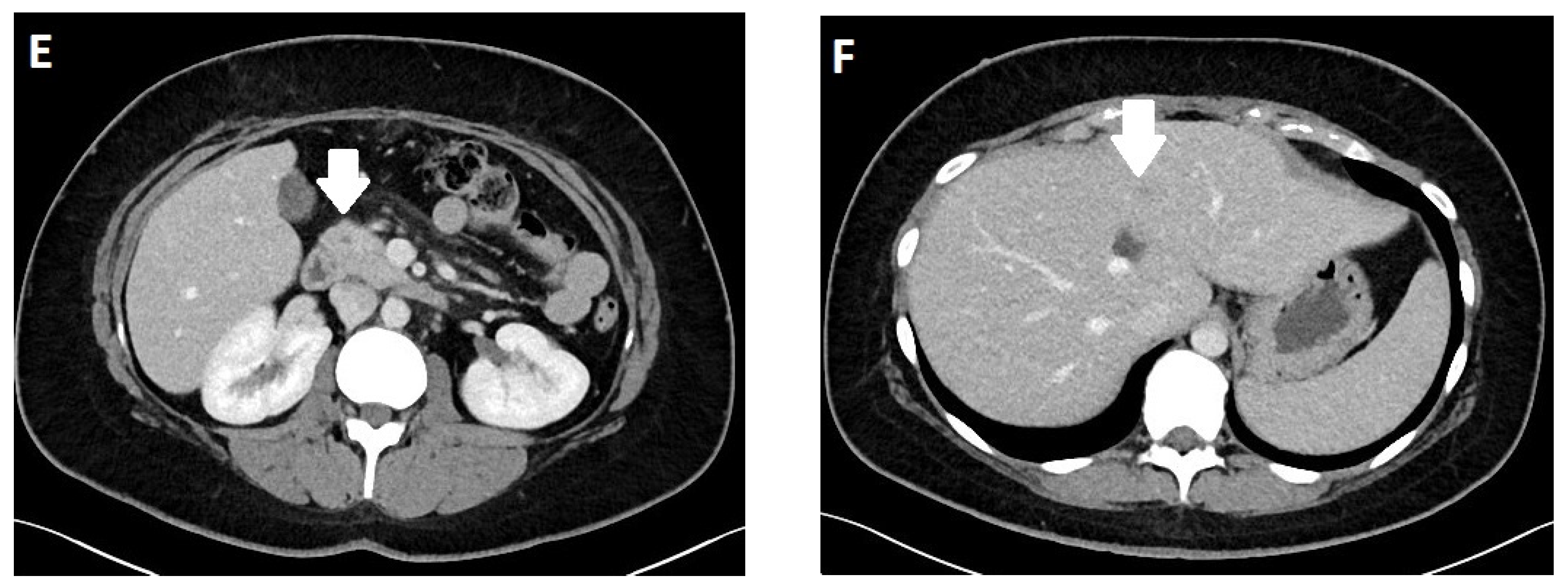 Diagnostics 13 02741 g007b